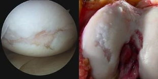 the images of the surfaces of the knee joint