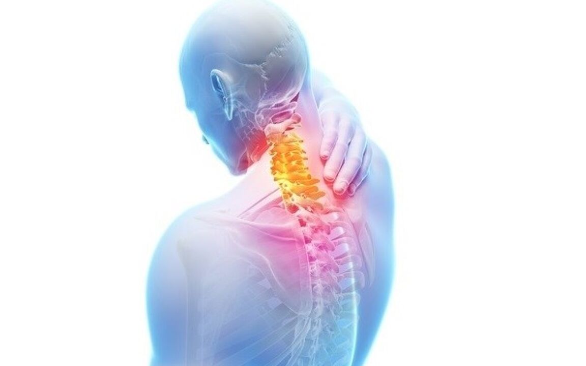 neck pain in osteochondrosis